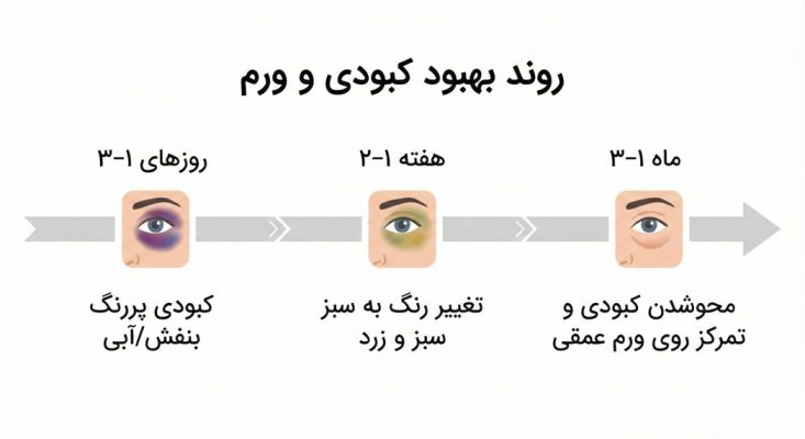 کبودی بعد از عمل بینی 1 کبودی بعد از عمل بینی روند بهبود کبودی بعد از عمل بینی.png
